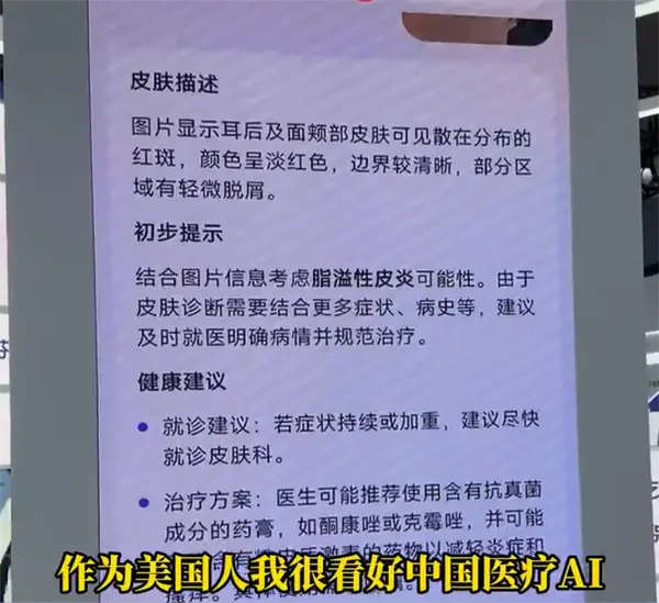 博主坦言美国看病太贵太麻烦：想把中国的ai医生带回去
